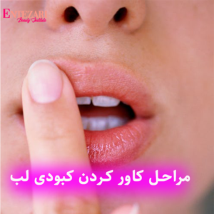 مراحل کاور کردن کبودی لب با میکروپیگمنتیشن