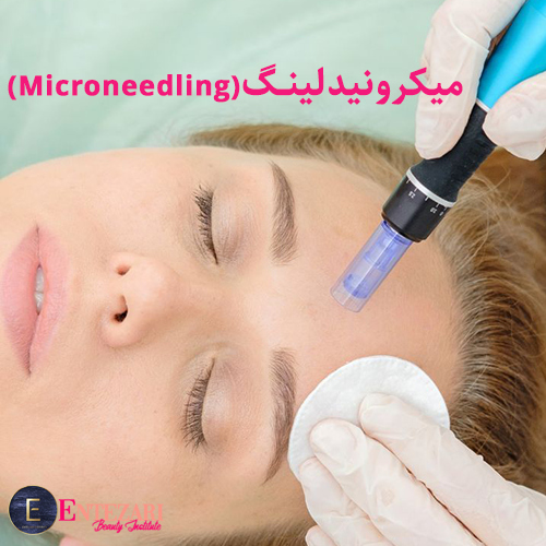 میکرونیدلینگ(Microneedling)