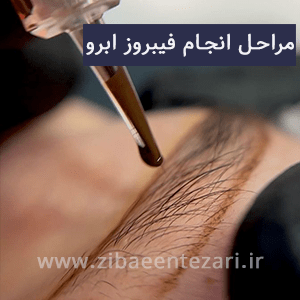 مراحل انجام کار فیبروز